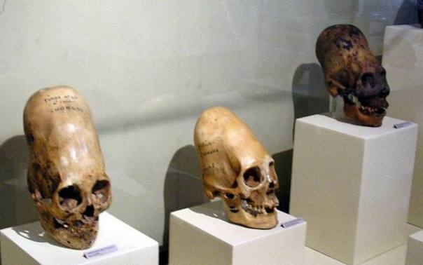 paracas-skulls-ica-museum